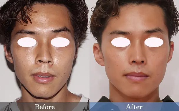 30代男性 Before / After