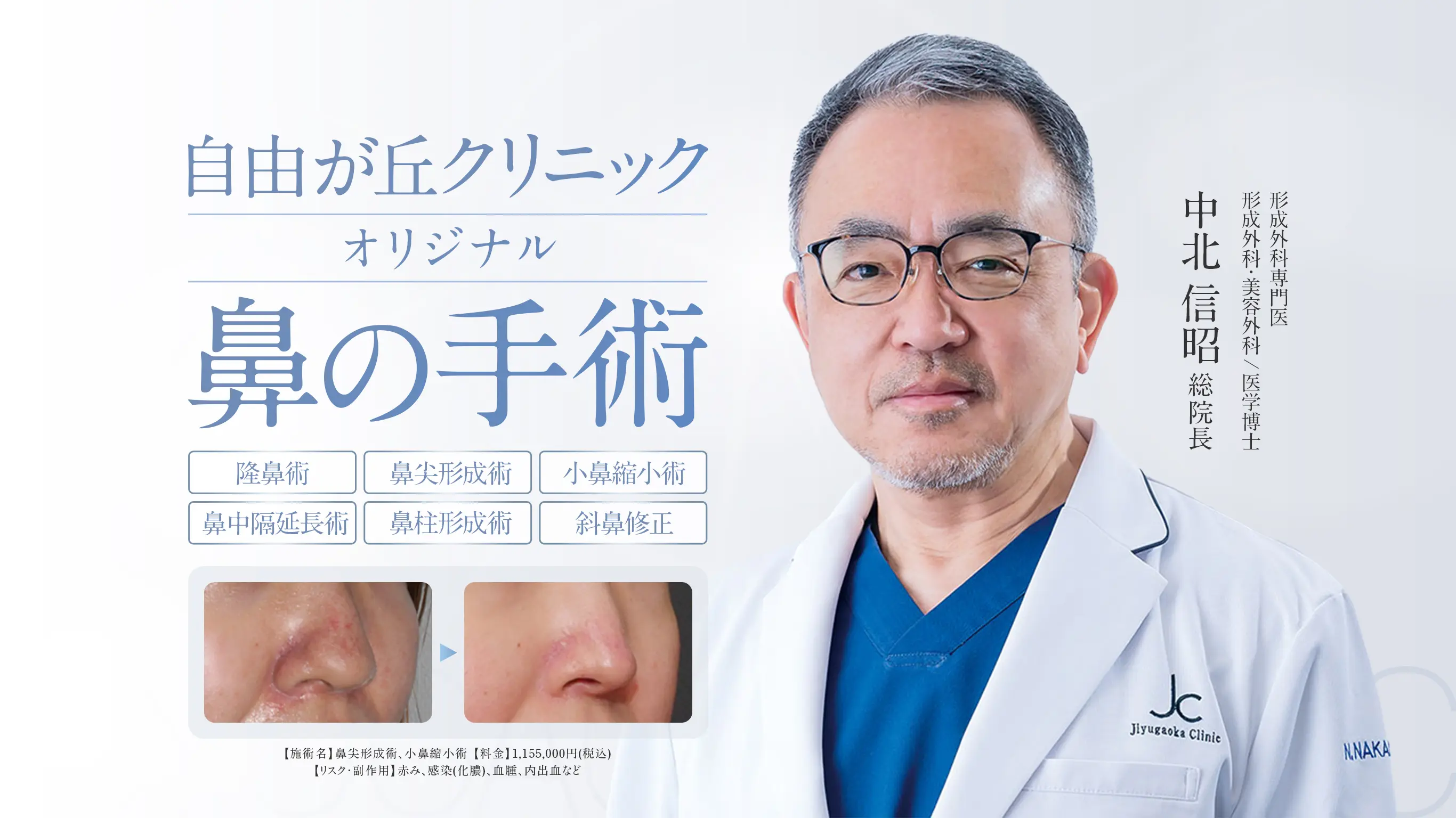 周囲にバレない自然な仕上がり、自由が丘式ヒアルロン酸注入 | 製薬メーカーが技術力を認めた「注入指導医」が担当